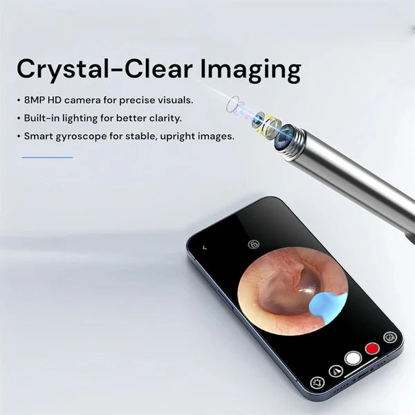 Smart Ear Cleaning Kit Wireless Camera with LED Light | Safe & Easy to Use